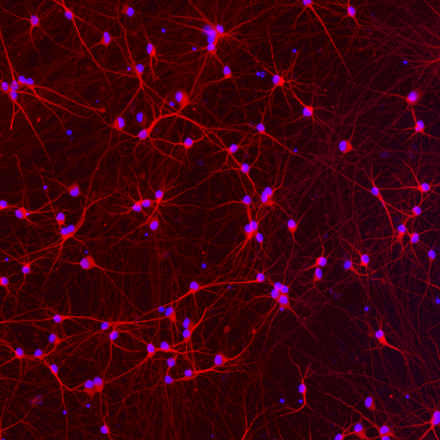 ioGlutamatergic Neurons APP KM670/671NL / KM670/671NL