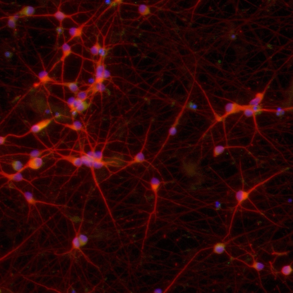 ioGlutamatergic Neurons MAPT P301S/WT