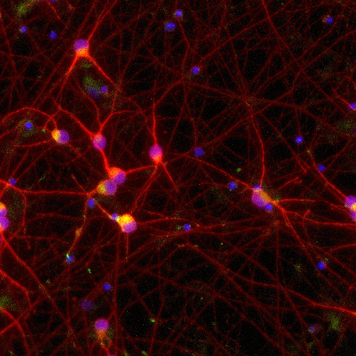 ioGlutamatergic Neurons TDP‑43 M337V/WT