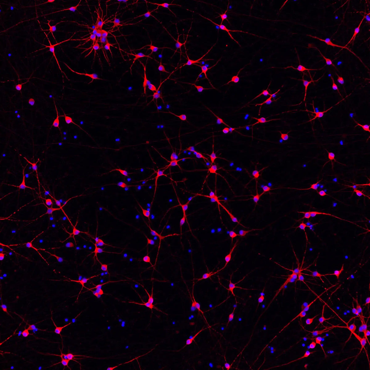 ioGlutamatergic Neurons APOE 4/4