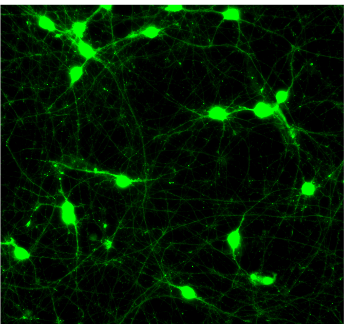 GFP ioMotor Neurons