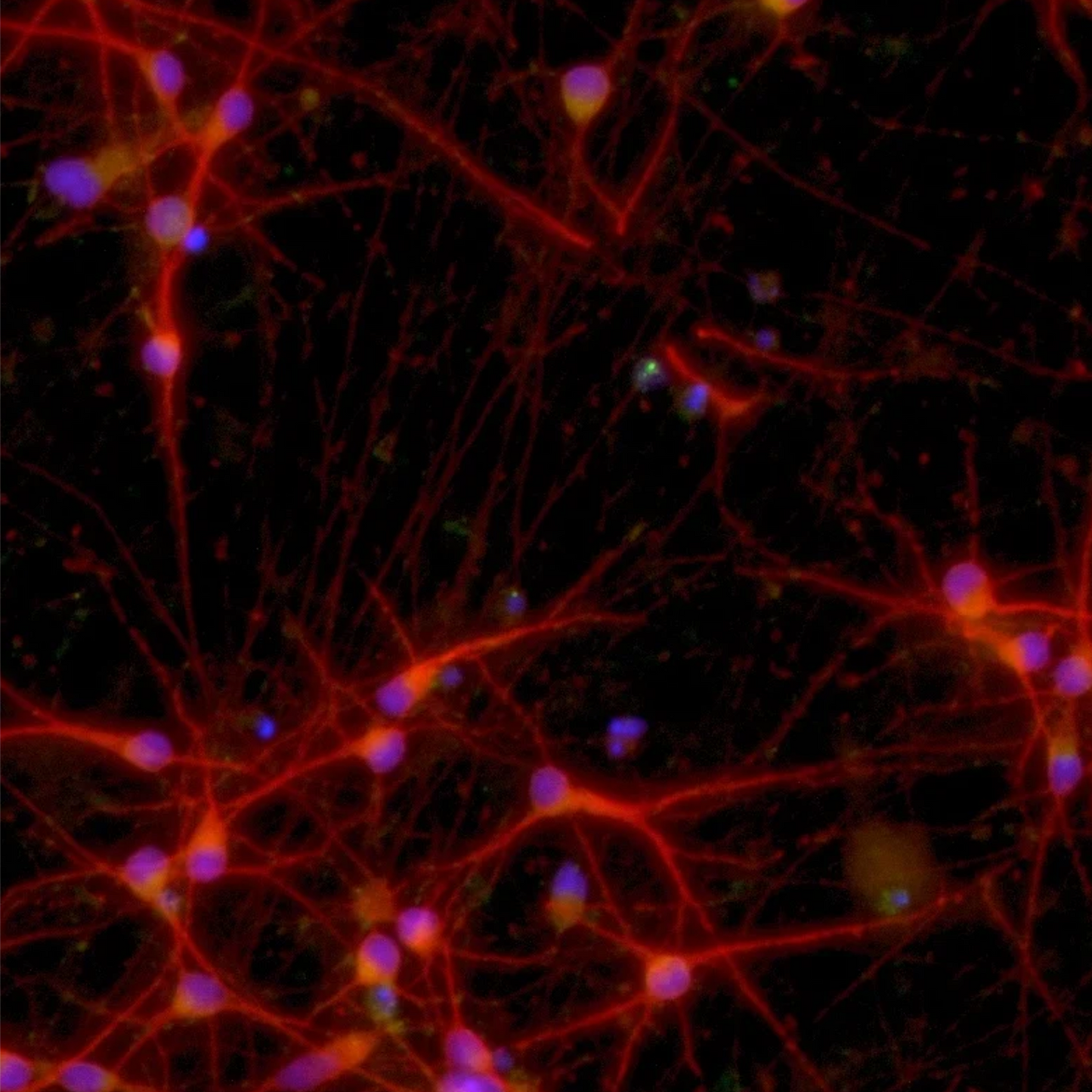 ioGlutamatergic Neurons MAPT P301S/P301S