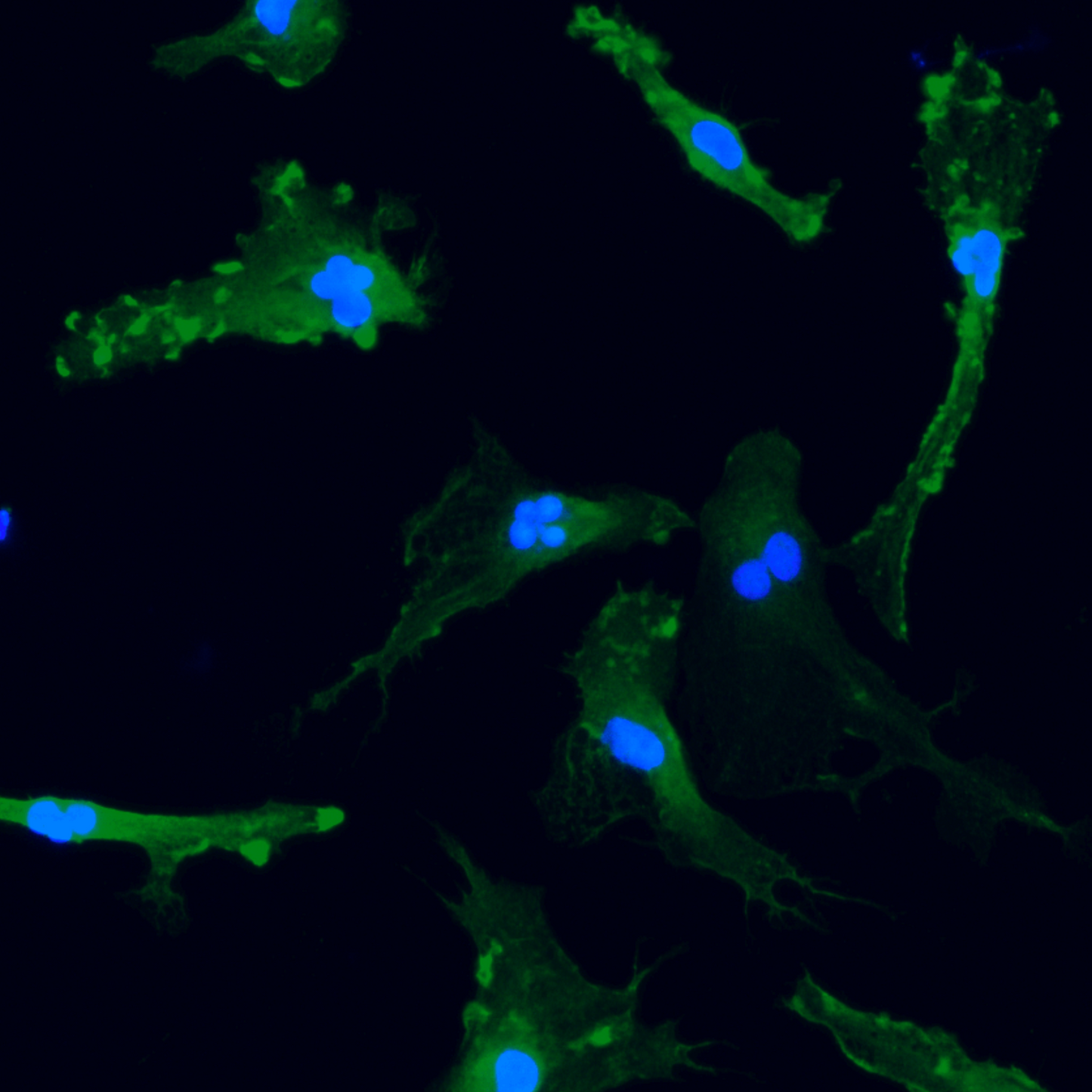 ioMicroglia TREM2 R47H/WT