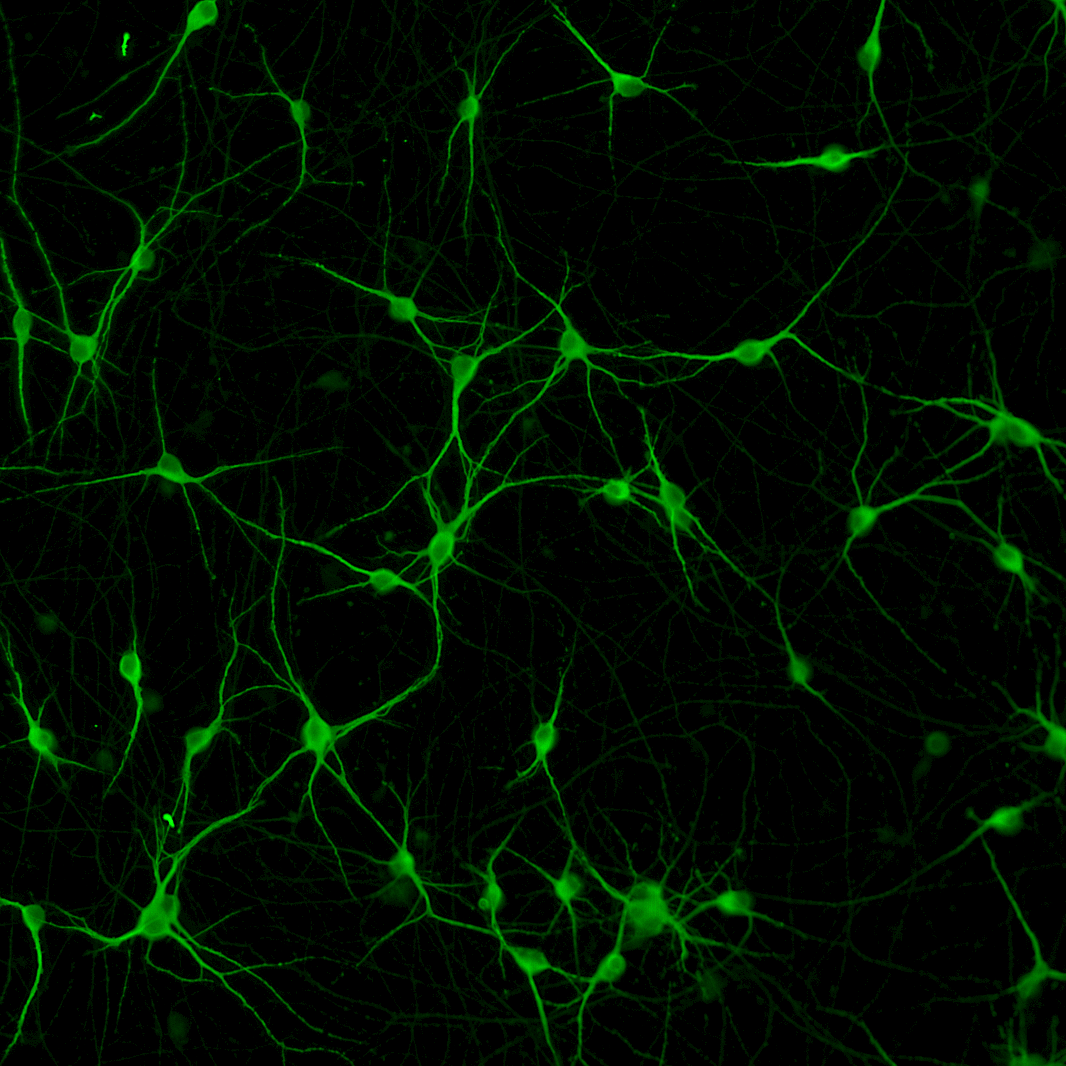 ioMotor Neurons SOD-1 G93A/WT