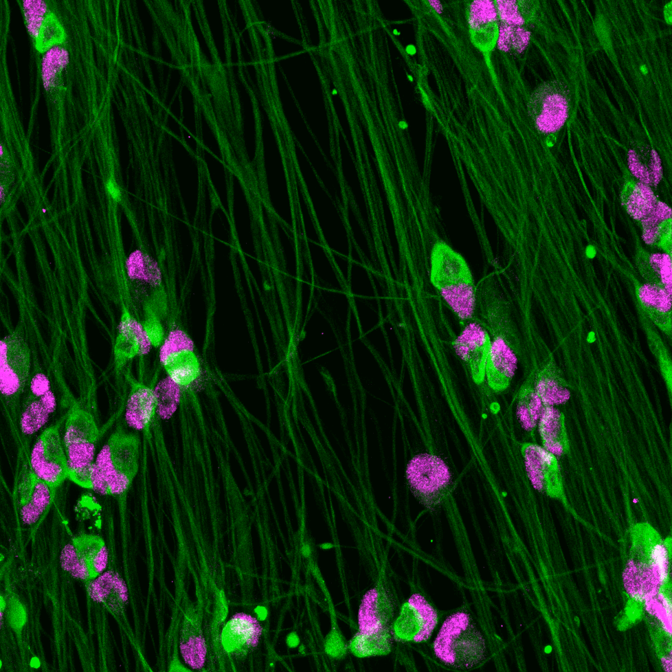 ioSensory Neurons