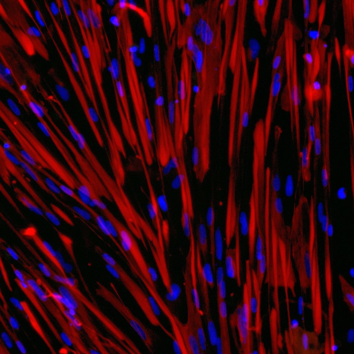 ioSkeletal Myocytes DMD Exon 52 Deletion