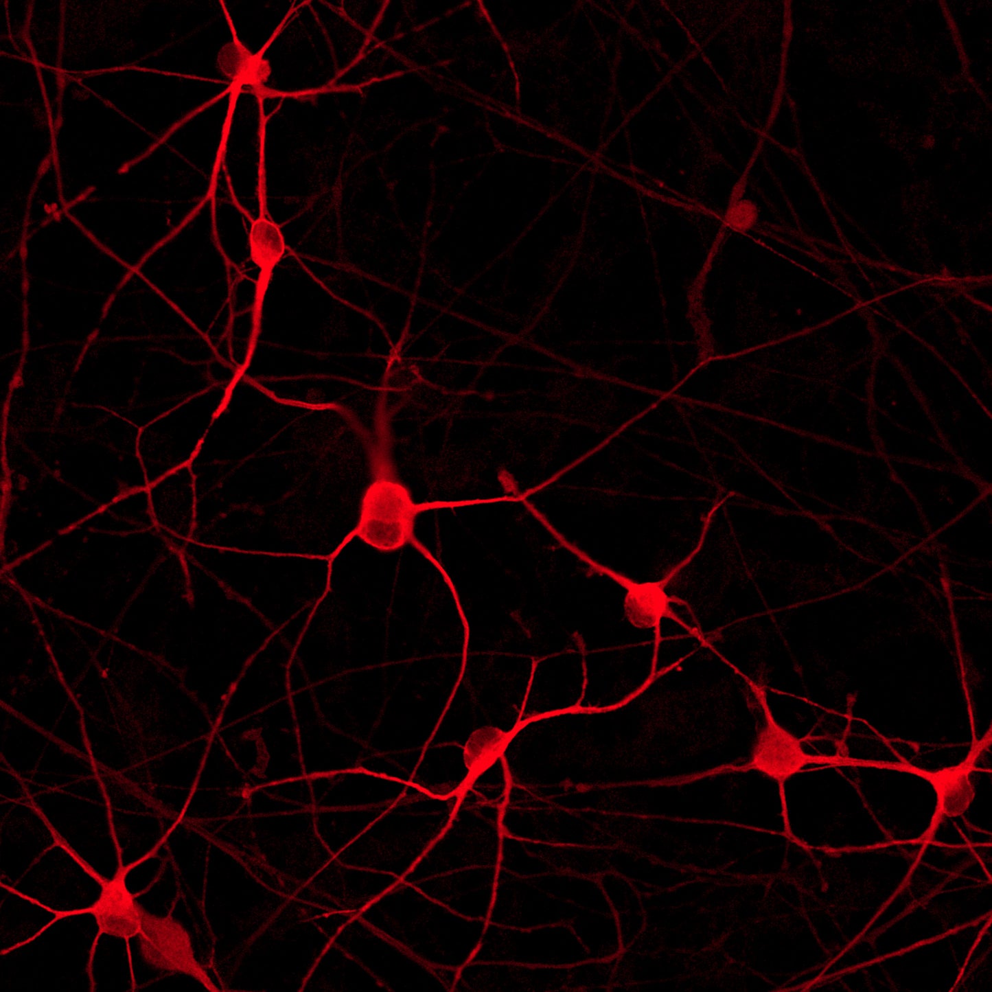 ioGlutamatergic Neurons PRKN R275W/WT
