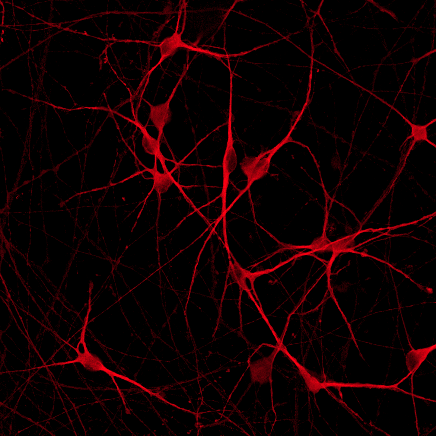 ioGlutamatergic Neurons PRKN R275W/R275W