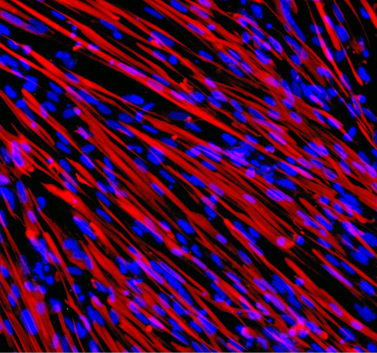ioSkeletal Myocytes DMD Exon 44 Deletion