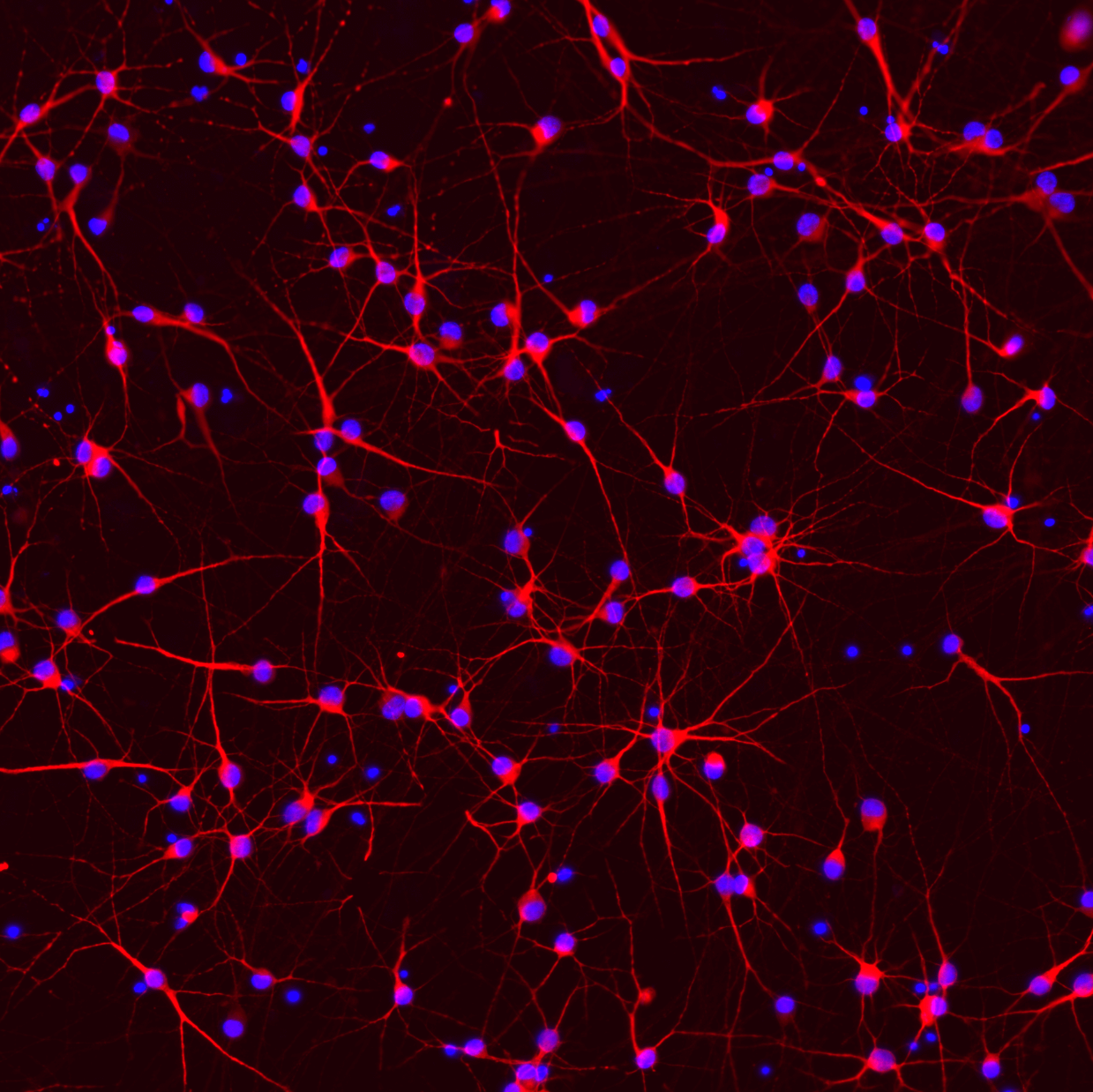 ioGlutamatergic Neurons PINK1 Q456X/WT