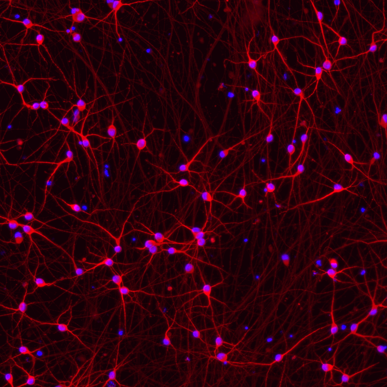 ioGlutamatergic Neurons PINK1 Q456X/Q456X