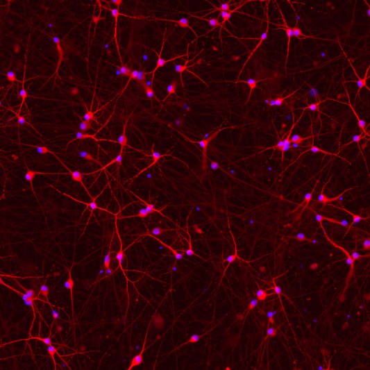 ioGlutamatergic Neurons PSEN1 M146L/WT