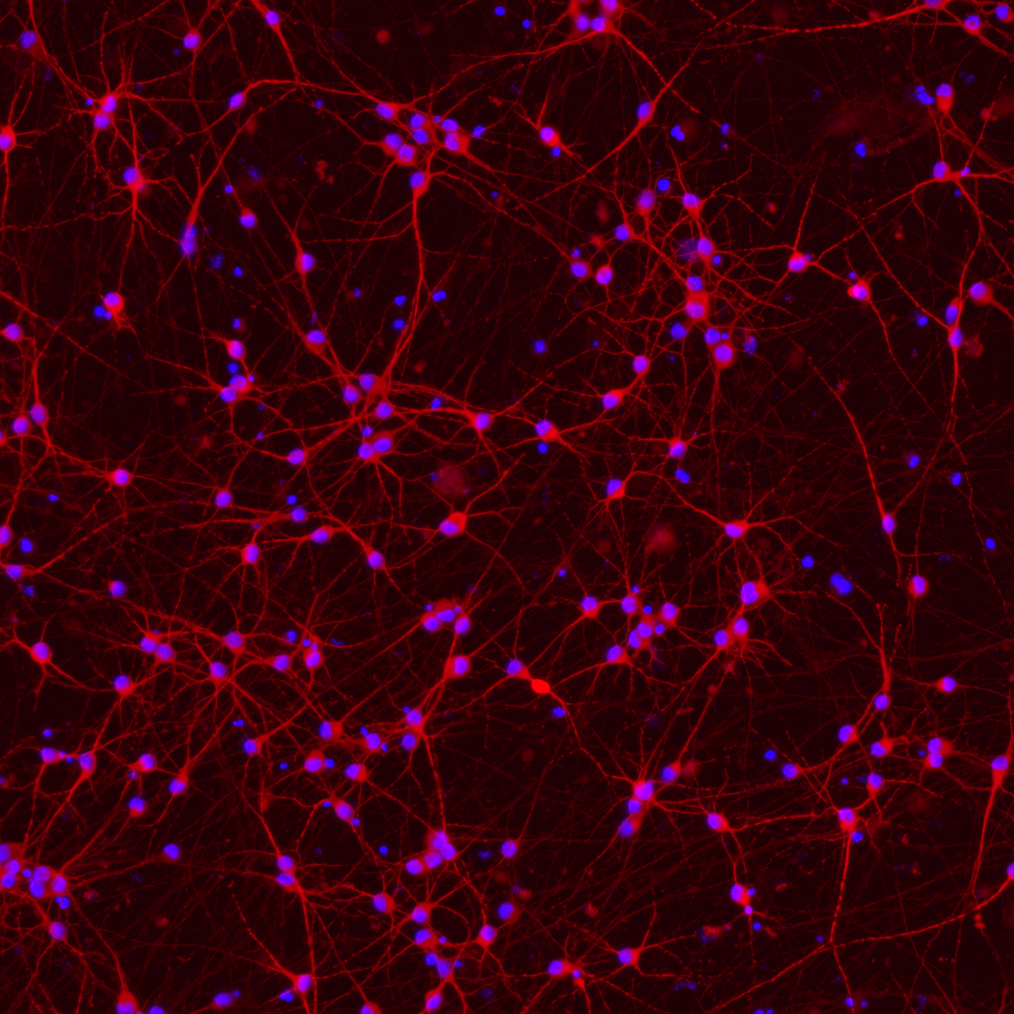 ioGlutamatergic Neurons PSEN1 M146L/M146L