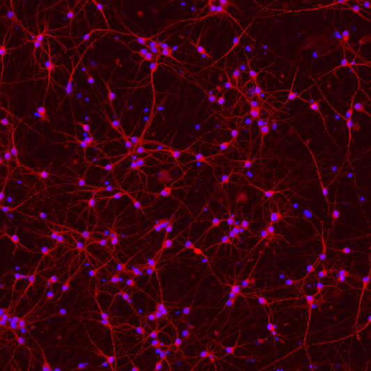 ioGlutamatergic Neurons PSEN1 M146L/M146L