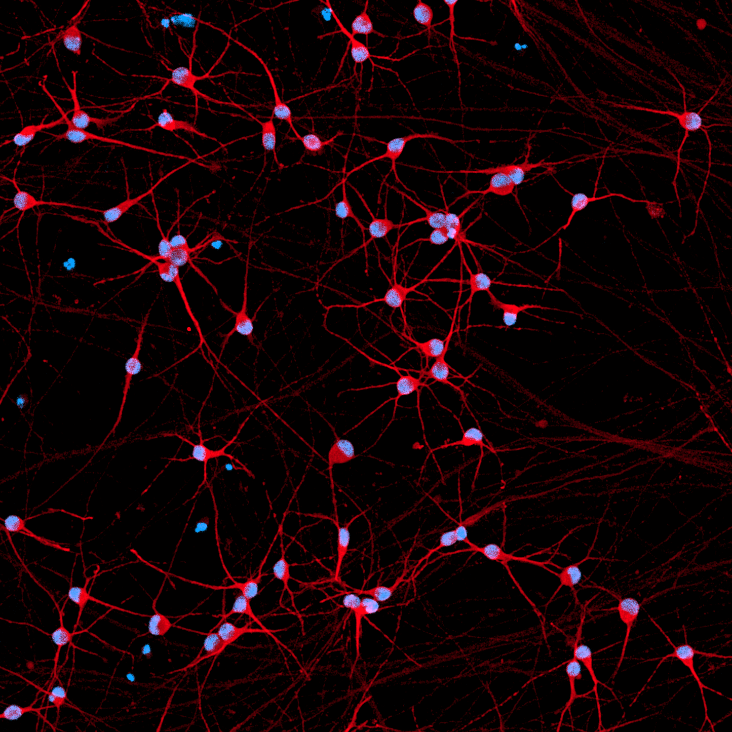 ioGlutamatergic Neurons SNCA A53T/A53T™