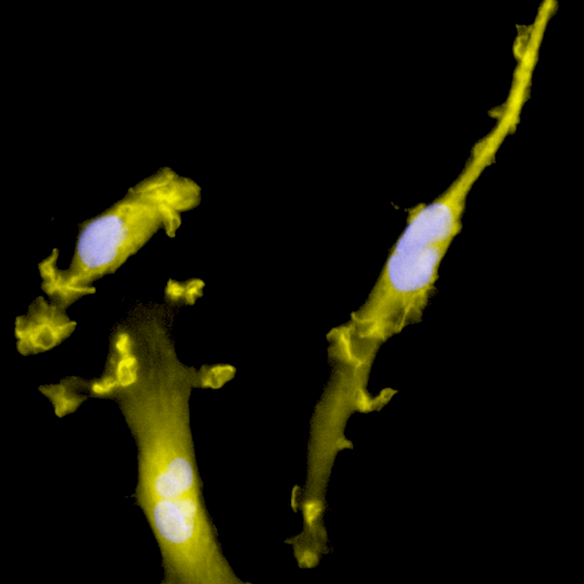 CRISPR-Ready ioMicroglia