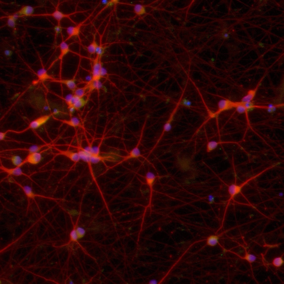 ioGlutamatergic Neurons MAPT P301S/WT™