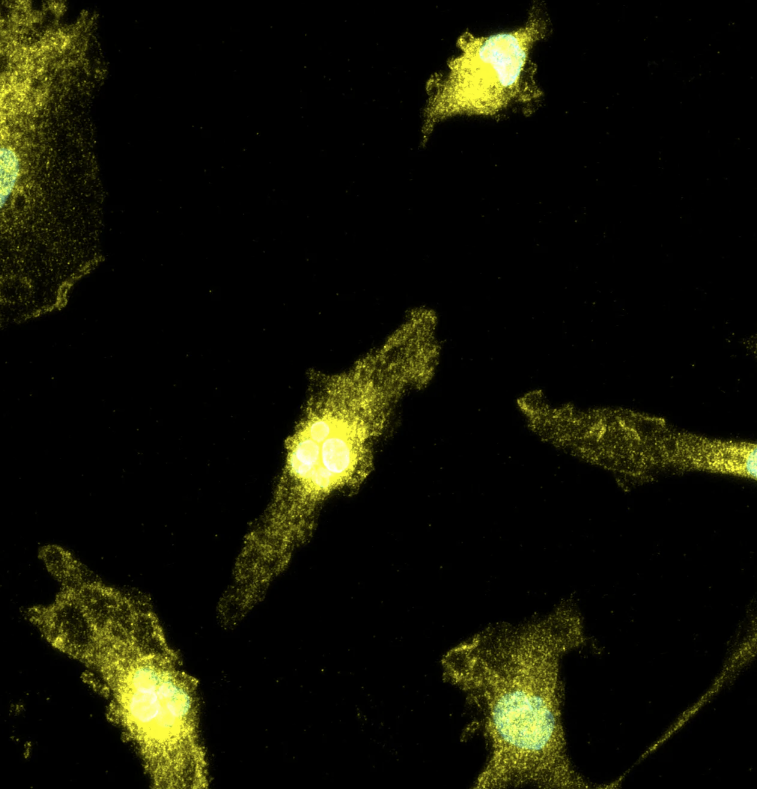ioMicroglia P2RY12 null/WT
