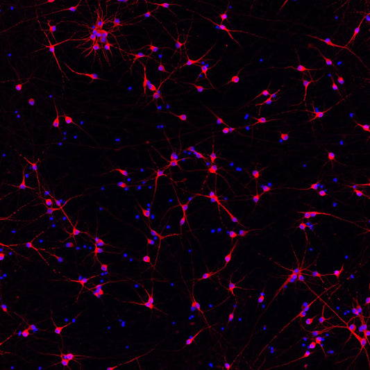 ioGlutamatergic Neurons APOE 4/4