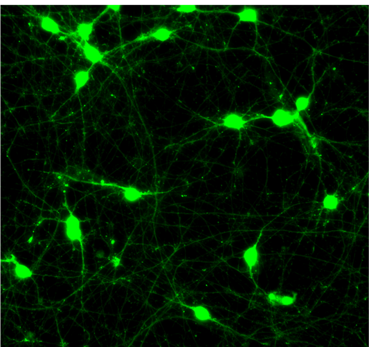GFP ioMotor Neurons
