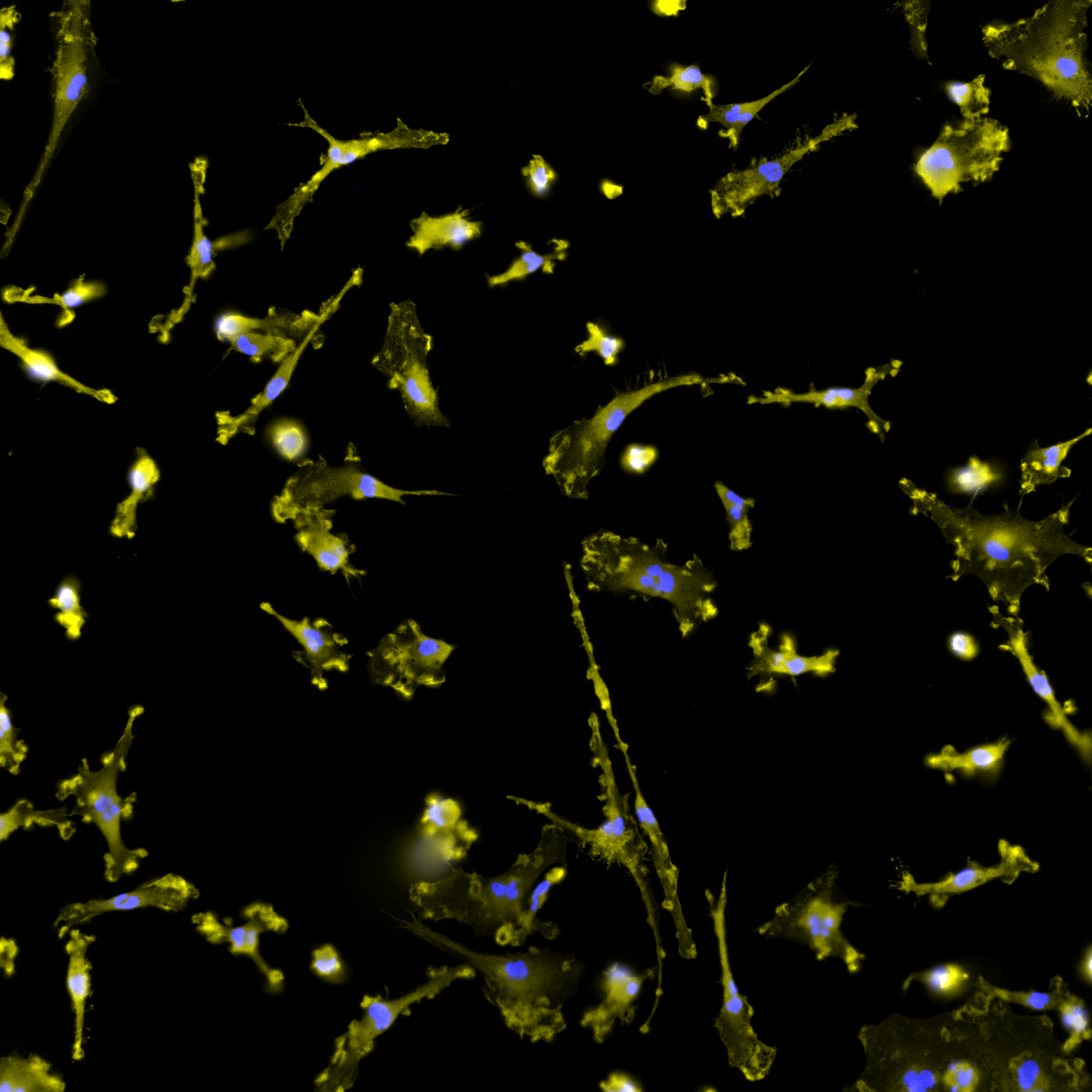 ioMicroglia GPNMB null/null