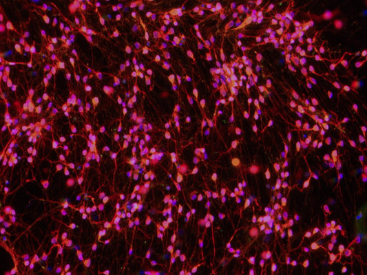 ioGABAergic Neurons APP V717I/WT™