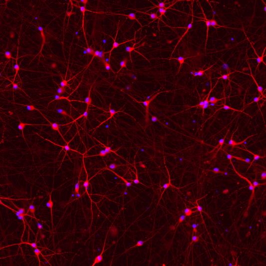 ioGlutamatergic Neurons MAPT S305N/[S305N;P301S]