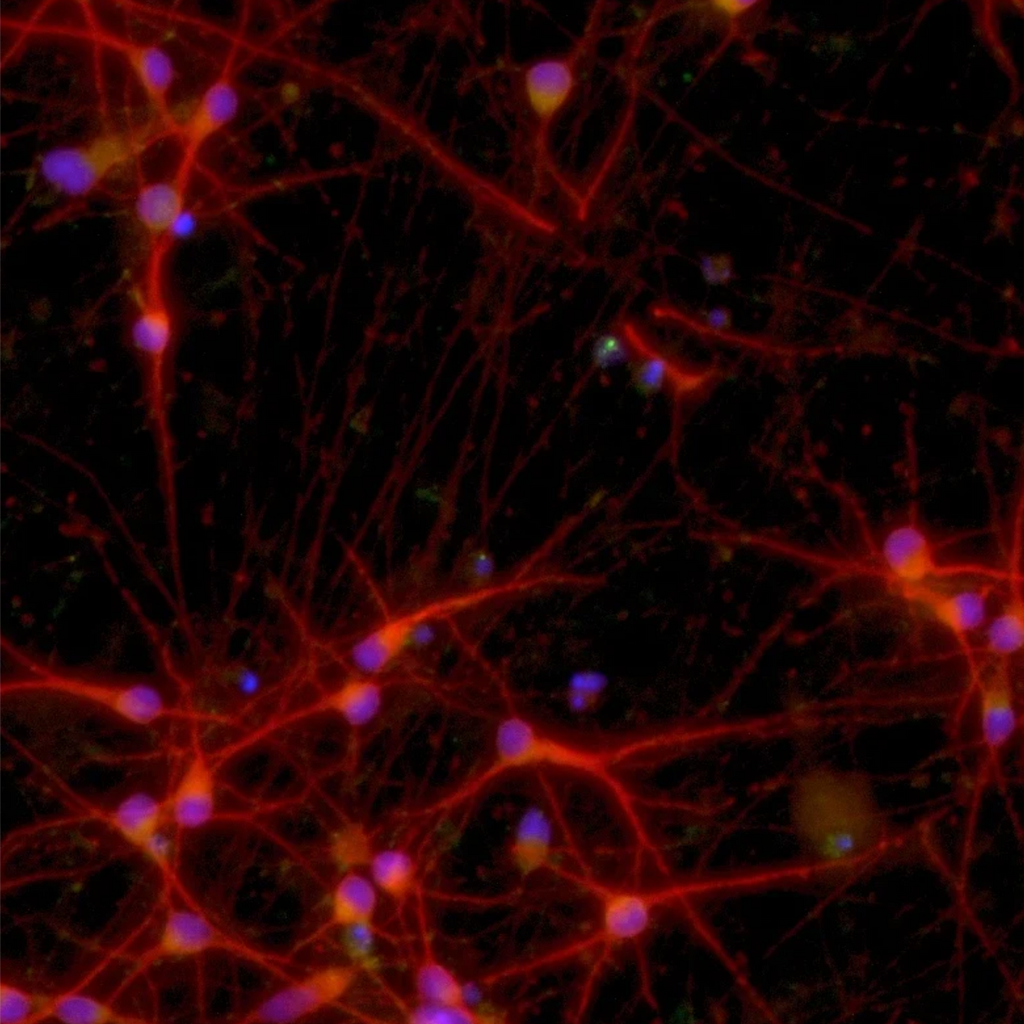 ioGlutamatergic Neurons MAPT P301S/P301S™