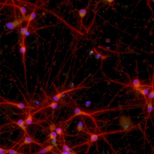 ioGlutamatergic Neurons MAPT P301S/P301S™