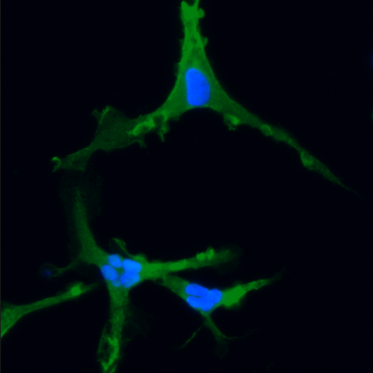 ioMicroglia APOE 4/3 C112R/WT