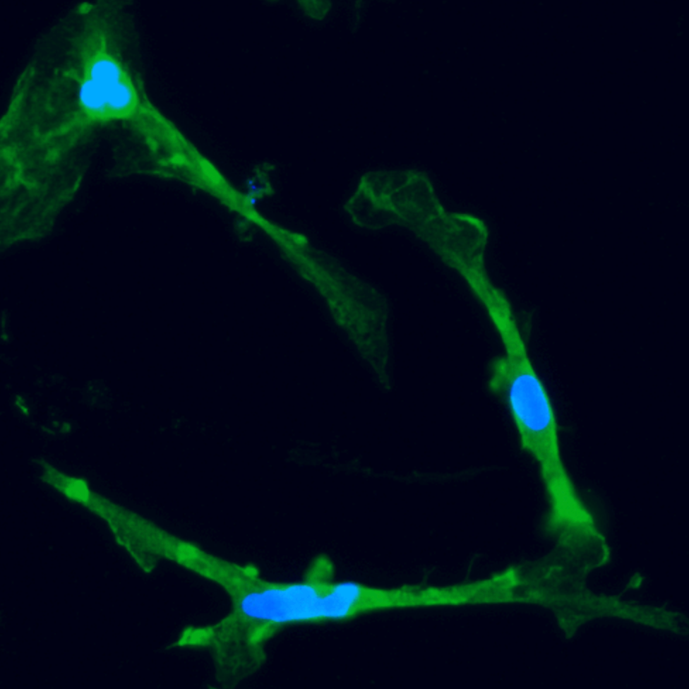 ioMicroglia TREM2 R47H/R47H