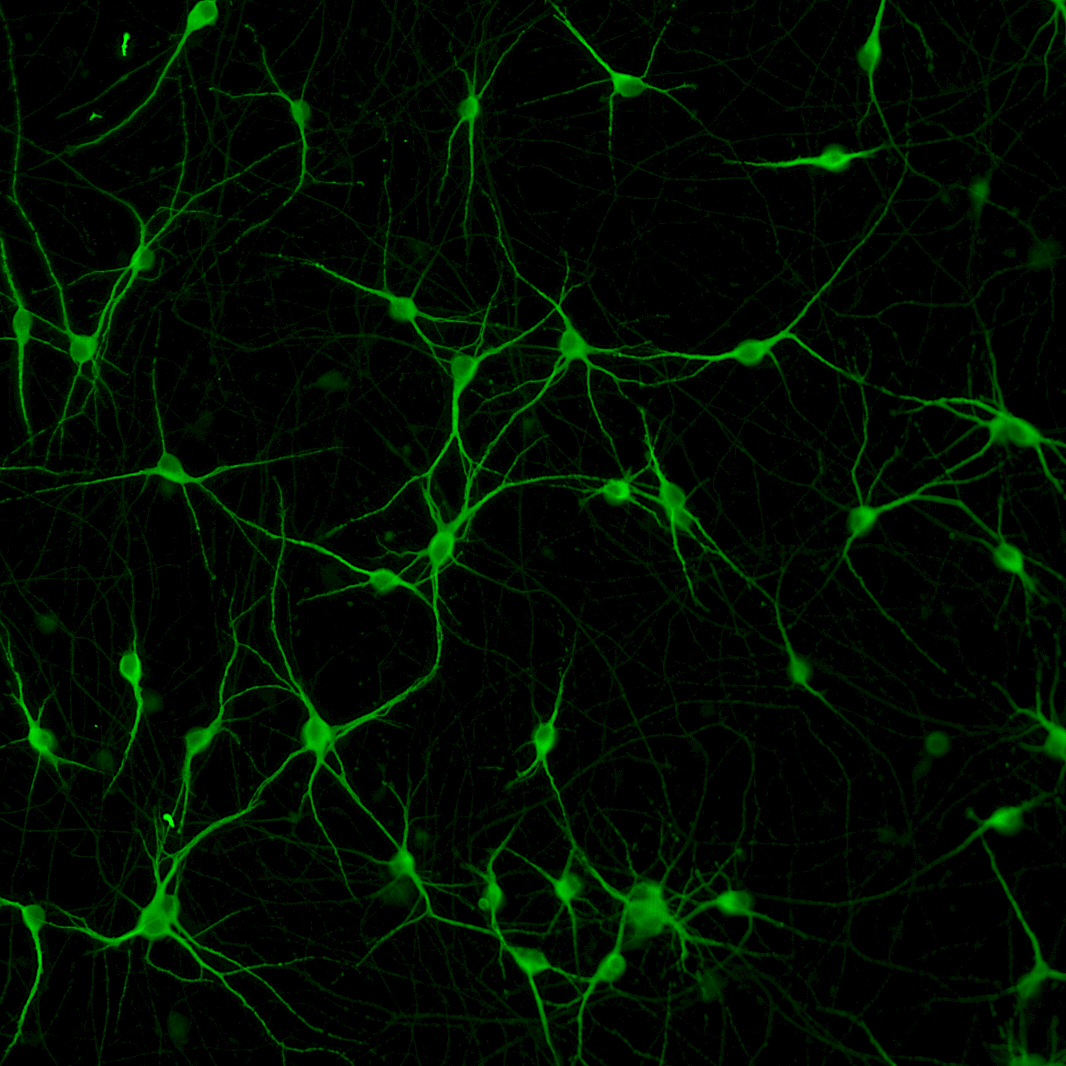 ioMotor Neurons SOD-1 G93A/G93A