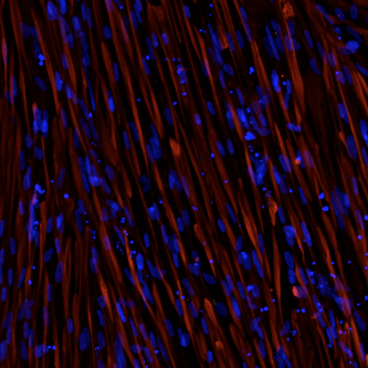 ioSkeletal Myocytes DMD Exon 51 Deletion