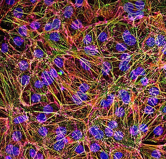 myrCell SarcPaint Ventricular Cardiomyocytes