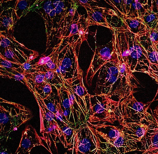 myrCell SarcPaint Ventricular Cardiomyocytes TTN A-band mutation