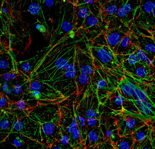 myrCell Ventricular Cardiomyocytes TTN A-band mutation
